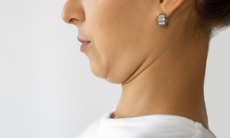 5 bài tập đơn giản giúp giảm cứng cổ, phục hồi vận động