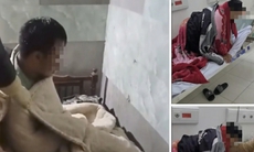 Một người tử vong nghi do bệnh dại sau 4 tháng bị chó cắn nhưng không tiêm phòng