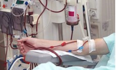 Tầm soát sớm, điều trị kịp thời, giảm gánh nặng căn bệnh hơn 10 triệu người Việt đang mắc