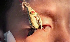 Suýt mù mắt khi đi câu cá, cảnh báo tai nạn nghiêm trọng