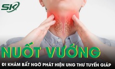 Nuốt vướng, mệt mỏi đi khám bất ngờ phát hiện ung thư tuyến giáp