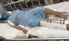 Cảnh khó khăn của cô gái dân tộc Mảng bị tai nạn giao thông cần sự trợ giúp của cộng đồng