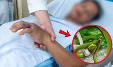 Rắn độc cắn trong lúc làm vườn, người đàn ông 44 tuổi nhập viện trong nguy kịch