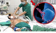 Người đàn ông 61 tuổi suy đa tạng, xuất huyết hoại tử vì thói quen phổ biến