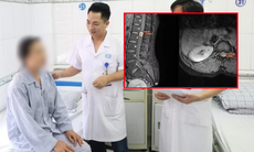 Đau lưng đến mất ngủ, người phụ nữ 39 tuổi đi khám phát hiện u tủy