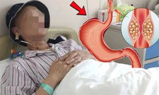 Duy trì 1 thói quen, người đàn ông 53 tuổi phát hiện ung thư từ rất sớm