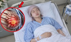 Cô gái mới 19 tuổi đã mắc ung thư vú, hối hận vì bỏ qua điều này
