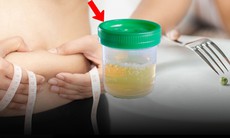 Nhịn ăn giảm cân, người phụ nữ 30 tuổi phát hiện tiểu đường, nước tiểu đầy bọt