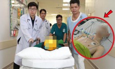 Bác sĩ cứu được tim nhưng không thể giữ được não cho nam thanh niên tự tử