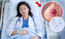 Nữ bác sĩ chuyên phẫu thuật ung thư vú lại mắc ung thư vú ở tuổi 35