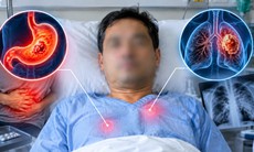 Tưởng đau dạ dày, người đàn ông bất ngờ mắc ung thư phổi giai đoạn cuối