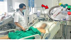 Người phụ nữ 51 tuổi suýt mất mạng vì tự ý truyền trắng tại nhà