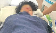 Nữ sinh lớp 9 bị bạn dùng dao chém đa chấn thương hiện ra sao?