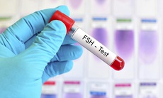 Mách bạn 7 cách tự nhiên giúp cân bằng nội tiết tố hiệu quả