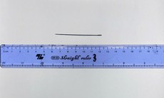 Lấy thành công kim khâu dài 6 cm nằm trong gan người đàn ông 