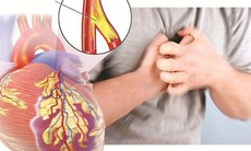 Lối sống thiếu lành mạnh, stress kéo dài khiến bệnh tim mạch dần trẻ hoá