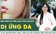 [LIVE] Dị ứng da mẩn ngứa khi trời lạnh, phải làm sao?