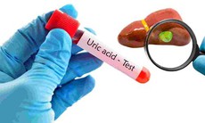 Cách dùng cần tây hỗ trợ giảm axit uric tại nhà: Lợi ích và những điều cần lưu ý