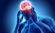 6 bí quyết giúp phòng ngừa đau đầu