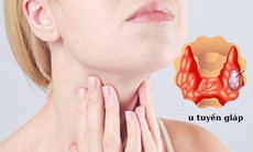 Dược thiện cho tuyến giáp: 5 nhóm thực phẩm bổ trợ và những loại cần kiêng kỵ