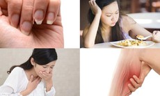 5 dấu hiệu cơ thể đang 'kêu cứu' vì thiếu vi chất trầm trọng