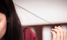 Tật giật, nhổ tóc gây tổn thương da đầu và sức khoẻ tinh thần như thế nào?