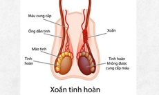 Nam sinh 14 tuổi phải cắt bỏ tinh hoàn do nhập viện muộn