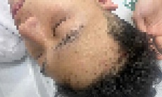 Công an Hà Nội điều tra vụ nam sinh bị nhóm đi ô tô ngược chiều chặn đầu, đánh hội đồng nhập viện