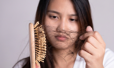 Sự thật về rụng tóc khi dùng biện pháp tránh thai nội tiết tố