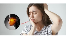 Dinh dưỡng hỗ trợ phòng ngừa biến chứng của viêm khớp thái dương hàm