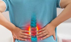 Đau lưng kéo dài, tê chân có thể là dấu hiệu của tình trạng hẹp ống sống 