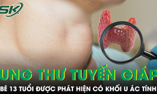 Bé 13 tuổi ung thư tuyến giáp, bác sĩ cảnh báo dấu hiệu dễ bỏ qua