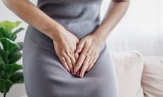 Vì sao vợ bị nấm âm đạo cần điều trị cho cả chồng?