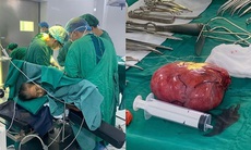 Phẫu thuật thành công khối u sau phúc mạc khổng lồ nằm ở vị trí phức tạp
