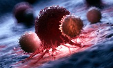 Y học thế giới tìm ra cách biến tế bào T thành 'siêu chiến binh' diệt ung thư