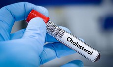 5 biện pháp không dùng thuốc kiểm soát cholesterol cao hiệu quả