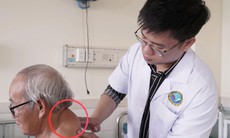 Mang khối u hơn 40 năm, cụ ông 72 tuổi được phẫu thuật thành công