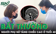 Người phụ nữ tăng chiều cao bất thường ở tuổi 40