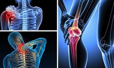 Không vận động mạnh tại sao vẫn bị thoái hoá?