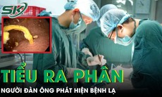 Người đàn ông tiểu ra phân, được phát hiện mắc bệnh lạ