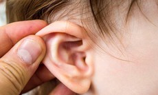 Viêm tai giữa tái phát ở trẻ không chủ quan với những yếu tố nguy cơ quen thuộc