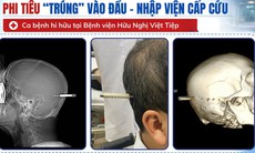 Người đàn ông bị phi tiêu cắm trúng đầu nhập viện khẩn cấp
