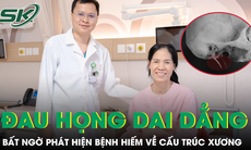 Thường xuyên bị đau họng, người phụ nữ bất ngờ phát hiện bệnh hiếm khi đi khám