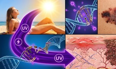 Nắng nóng mùa hè khiến nguy cơ ung thư da tăng cao
