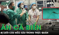 Hiếm gặp: Ăn cá biển, người đàn ông bị lưỡi câu mắc sâu trong thực quản