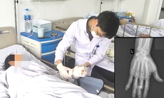 Vi phẫu cứu ngón tay đứt lìa cho nữ công nhân phụ hồ bị máy trộn bê tông cuốn nát bàn tay