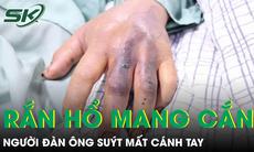 Đi làm ruộng bị rắn hổ mang cắn, người đàn ông suýt mất cánh tay 