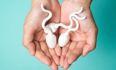 Số lượng tinh trùng của nam giới bao nhiêu là ít?