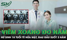 Viêm xoang do nấm, nữ sinh 18 tuổi tê nửa mặt, đau đầu suốt 3 năm
