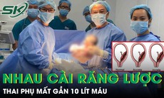 Thai phụ 36 tuần mất gần 10 lít máu, nguy hiểm tính mạng vì tai biến nhau cài răng lược